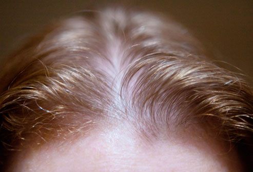 how to regrow lost hair naturally at home